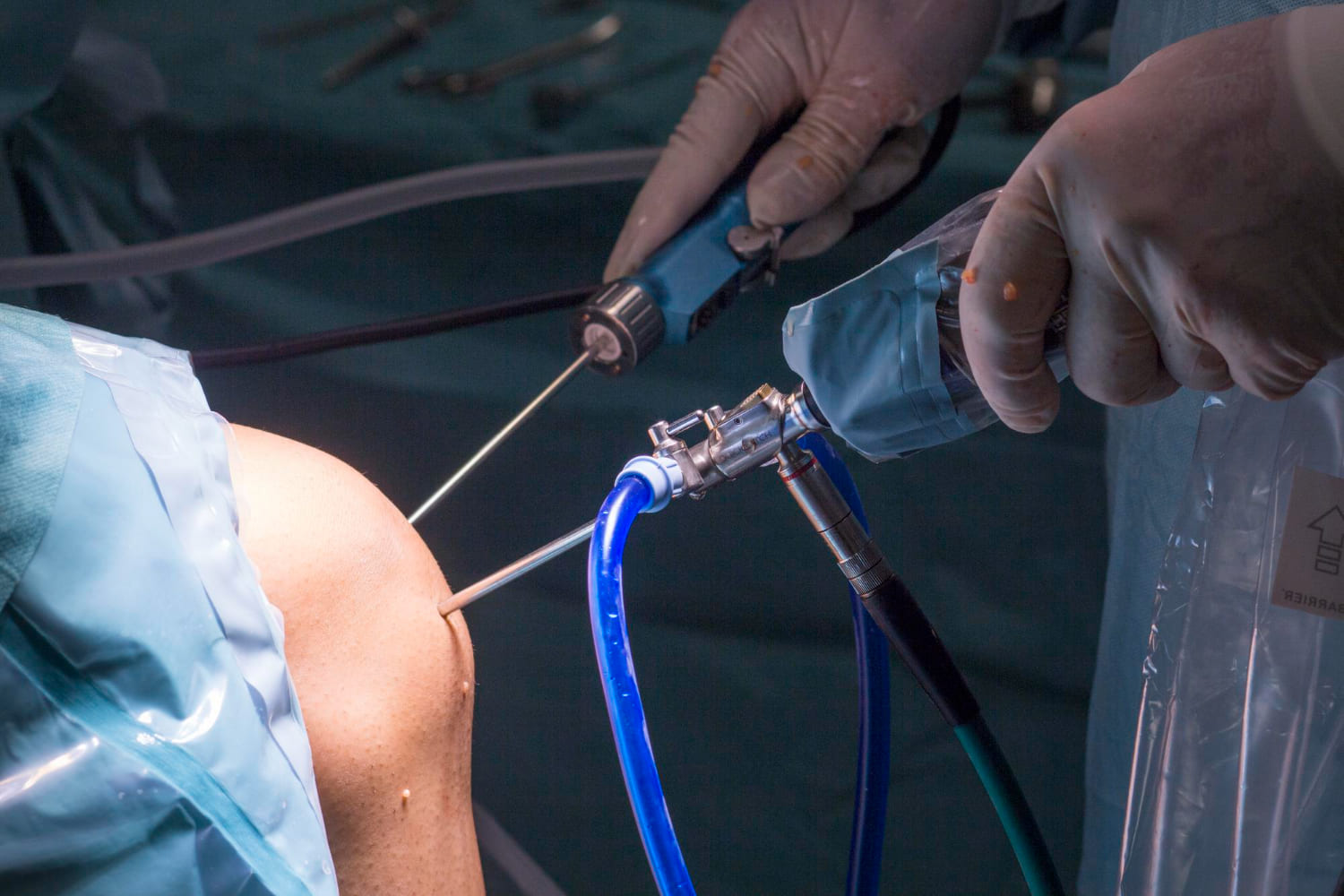 Cirugía artroscópica de rodilla y hombro