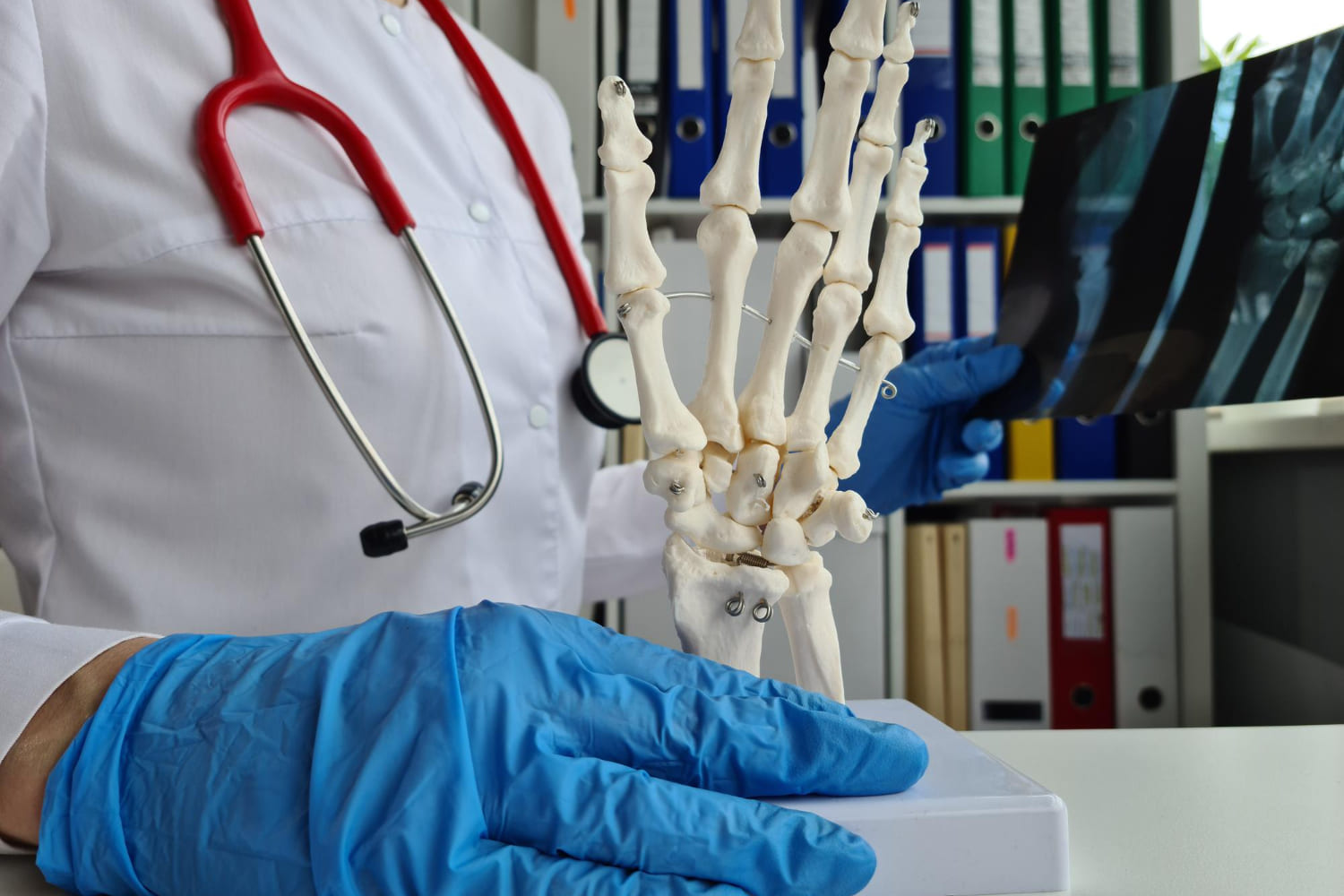 Tratamiento de esguinces y luxaciones